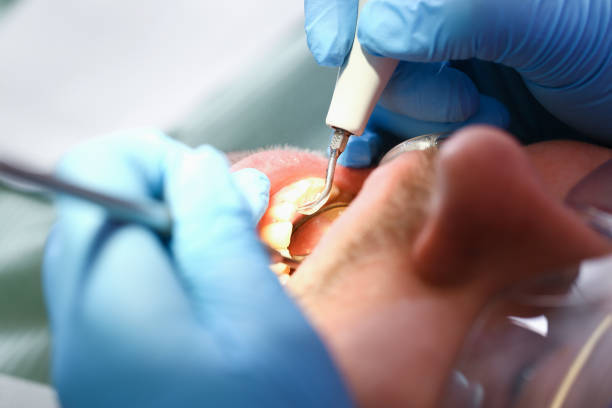 Best Pediatric Emergency Dentist in Akron, IA